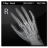 X Ray Hand-48